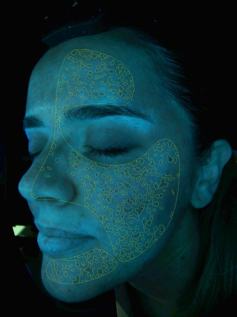 8_Cara izquierda-Pigmento profundo (2)